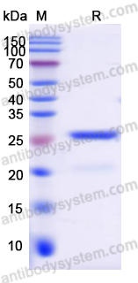 Lambda Protein Phosphatase (Lambda PP)