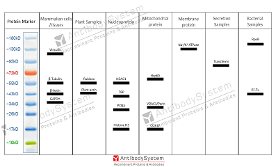 Choosing Flawless Loading Controls: Your Ultimate Guide of Western Blots
