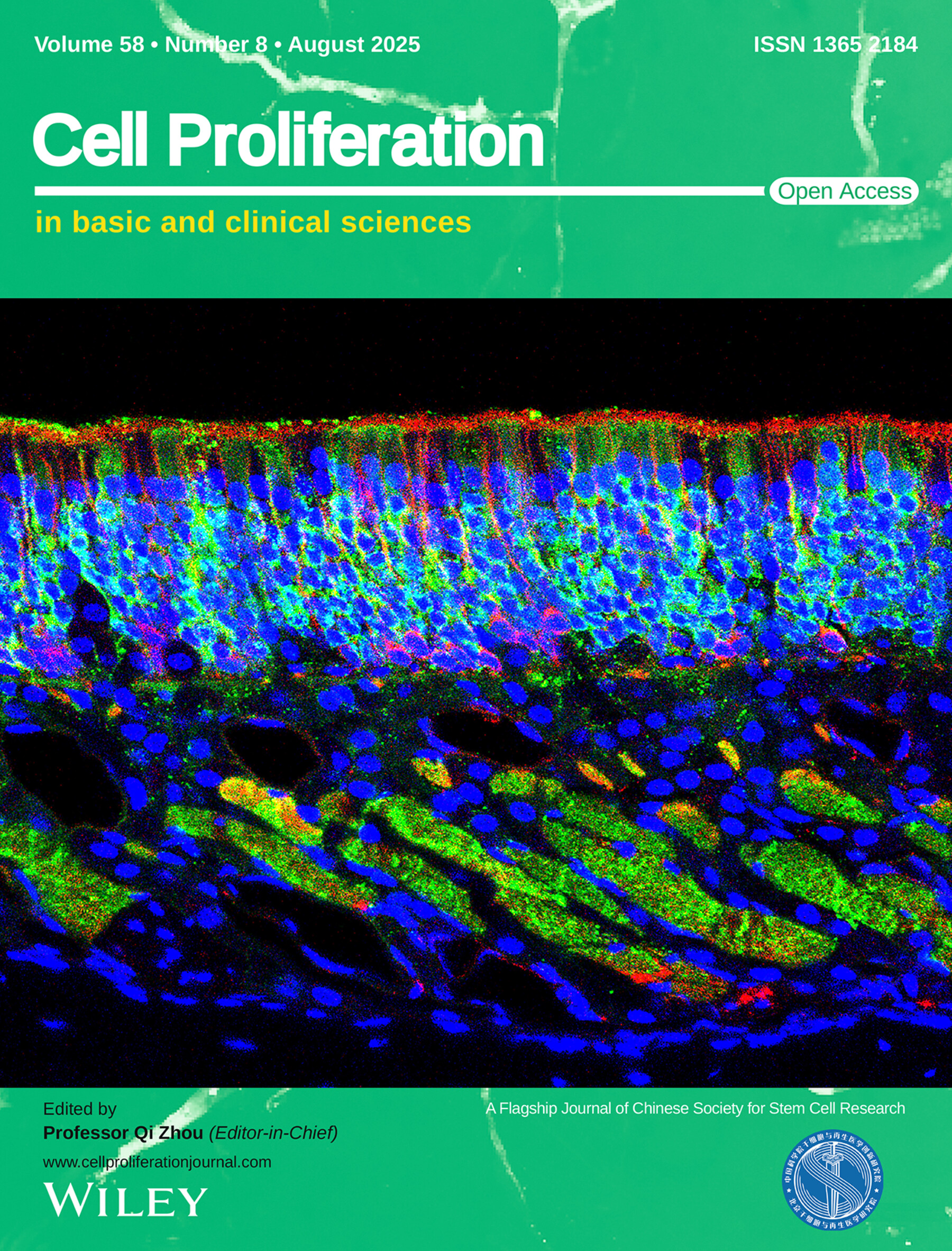 Soluble Sema4D From γδ T Cells Exerts Osteoblast Inhibition via Plexin-B/mTOR Signalling Contributing to Pathogenesis of Bisphosphonate-Related Osteonecrosis of the Jaws