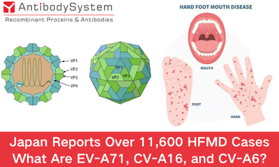 Japan Reports Over 11,600 HFMD Cases: What Are EV-71, CV-A16, and CV-A6?