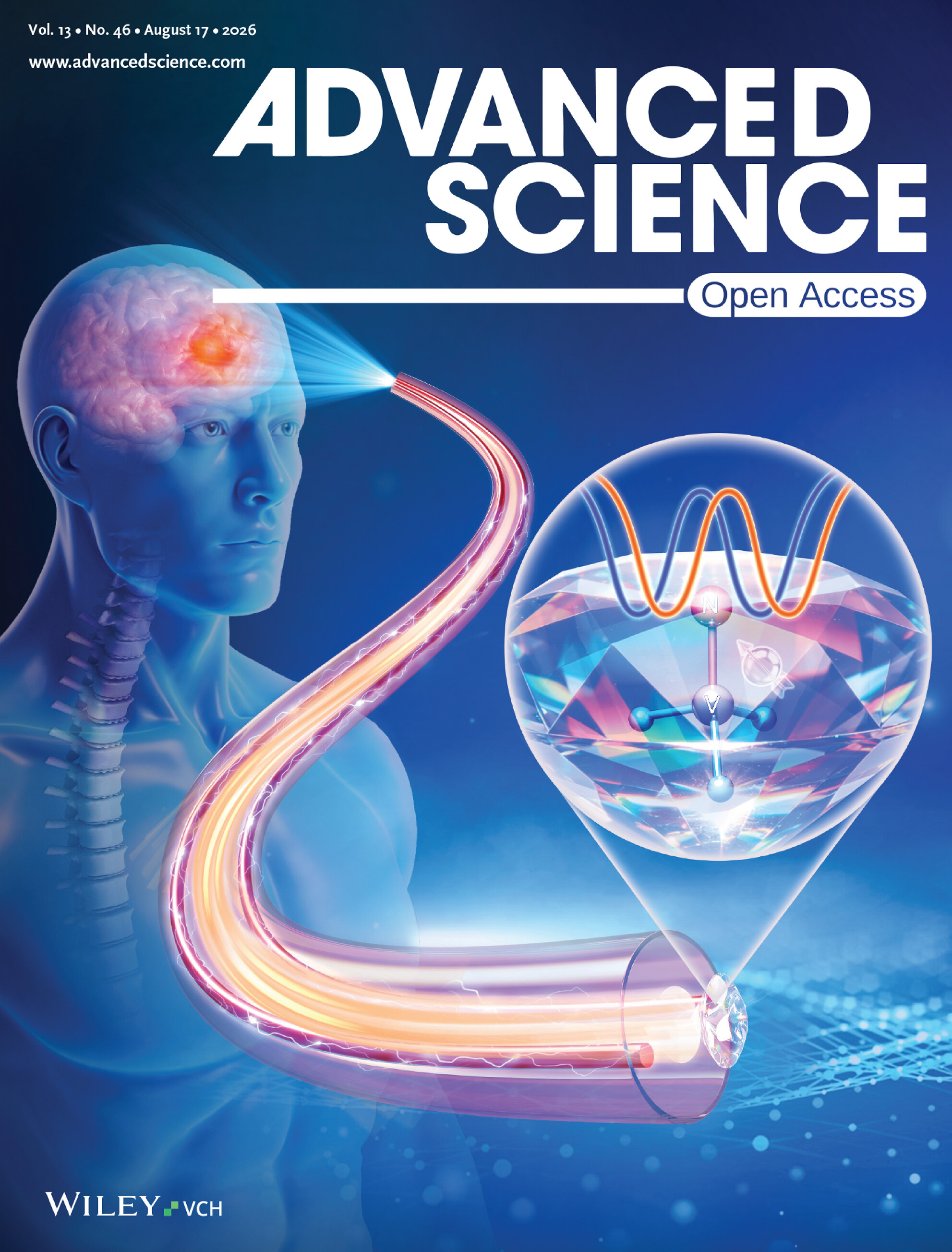 EBV-Driven ODC1 Upregulation Enhances Polyamine Anabolism to Promote Viral Replication and Cisplatin Resistance in Nasopharyngeal Carcinoma 