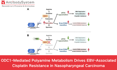 ODC1-Mediated Polyamine Metabolism Drives EBV-Associated Cisplatin Resistance in Nasopharyngeal Carcinoma