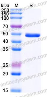 Recombinant Human Gal9/LGALS9 Protein, C-His (Active)