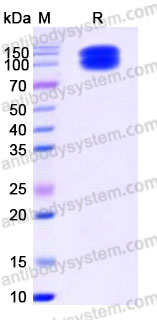 Recombinant Human CD203c/ENPP3 Protein, N-His (Active)