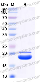 Recombinant Human CD262/TRAIL-R2/DR5 Protein, C-His (Active)