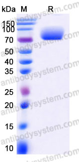 Recombinant Human CD304/NRP1 Protein, C-His (Active)