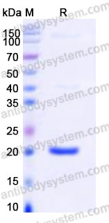 Recombinant Human CD254/RANKL Protein, Tag free (Active)