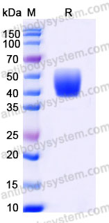 Recombinant Human CD263/TNFRSF10C Protein, C-His (Active)