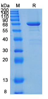 SDS-PAGE for Recombinant Human EPHB6 Protein, C-10*His (Active) ?>