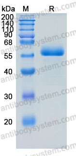 Recombinant Human SPINT1 Protein, C-10*His (Active)