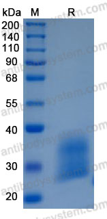 Recombinant Human SPINT2 Protein, C-10*His (Active)