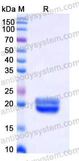 Recombinant Human CD258/LIGHT Protein, N-His (Active)