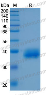 Recombinant Human CA12 Protein, C-10*His (Active)