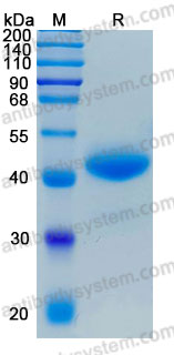 Recombinant Human ANGPTL7 Protein, C-His (Active)