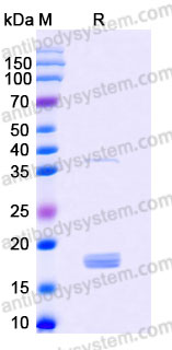 Recombinant Human VEGFD Protein, C-His (Active)