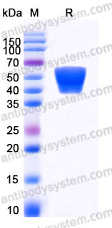 Recombinant Human CD16b/FCGR3B Protein, C-His (Active)