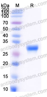 Recombinant Human FGF18 Protein, C-His (Active)