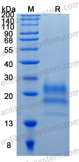 Recombinant Human CST7 Protein, C-His (Active)