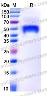 SDS-PAGE for Biotinylated Human DKK1 Protein, C-Avi-His ?>