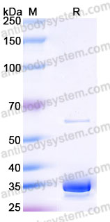 Biotinylated Human TNFSF15/TL1A Protein, N-6His-Avi