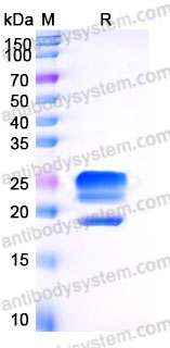 Recombinant Human TNFSF15/TL1A Protein, N-His (Active)