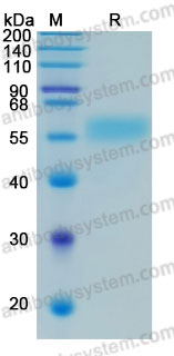 Recombinant Human CD218b/IL18RAP Protein, C-His (Active)