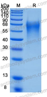 Recombinant Human LYPD3 Protein, C-His (Active)