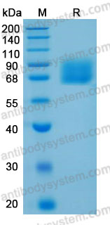 Recombinant Human VNN1 Protein, C-His (Active)