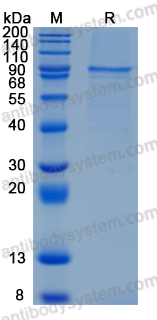 SDS PAGE for Recombinant Human NTN1/Netrin-1 Protein, C-His (Active) ?>