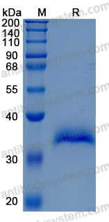 Recombinant Human FSTL3/FLRG Protein, C-His (Active)