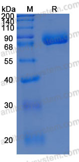 Recombinant Human CD355/CRTAM Protein, C-hFc-His (Active)