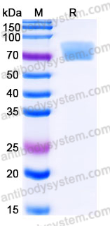 Recombinant Human EGFR vIII Protein, C-His (Active)
