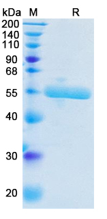 SDS-PAGE for Recombinant Human PLAU Protein, C-His (Active) ?>