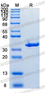 Recombinant Human CA1/Carbonic anhydrase 1 Protein, C-His (Active)