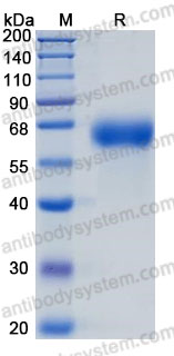 Recombinant Human SERPINC1 Protein, C-10*His (Active)