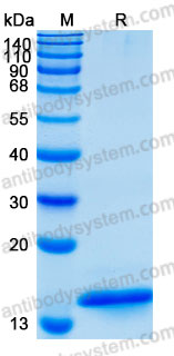 Recombinant Human CST1 Protein, C-His (Active)