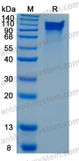 Recombinant Human KNG1 Protein, C-10*His (Active)