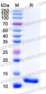 Recombinant Human EGF Protein, Tag free (Active)