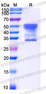 Biotinylated Human CD25/IL2RA Protein, C-His-Avi
