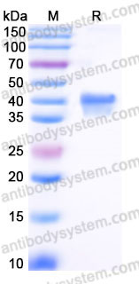 Recombinant Human CD25/IL2RA Protein, C-His (Active)