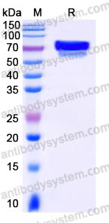 Recombinant Human CD25/IL2RA Protein, C-Fc (Active)