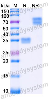 Recombinant Human CD8 alpha & beta Heterodimer, C-His (Active)