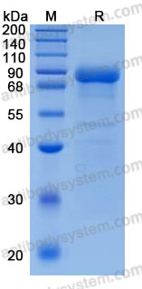 Recombinant Human KLKB1 Protein, C-His (Active)