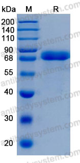 Recombinant Human A1BG Protein, C-His (Active)