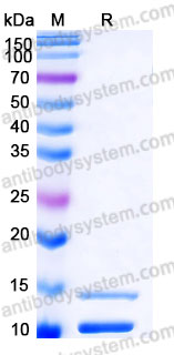 SDS-PAGE for Recombinant Human IGF1 Protein, Tag free (Active) ?>