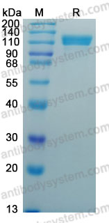 Recombinant Human APP Protein, C-His (Active)