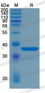 Recombinant Human ARG1/Arginase-1 Protein, C-His (Active)