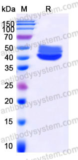 SDS-PAGE for Recombinant Human IL4 Protein, C-Fc (Active) ?>