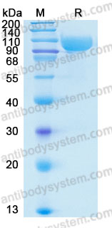 Recombinant Human SERPING1 Protein, C-His (Active)