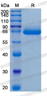 Recombinant Human ALPL Protein, C-His (Active)